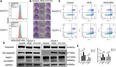 Hydroxychloroquine Induces Apoptosis in Cholangiocarcinoma via Reactive Oxygen Species Accumulation Induced by Autophagy Inhibition